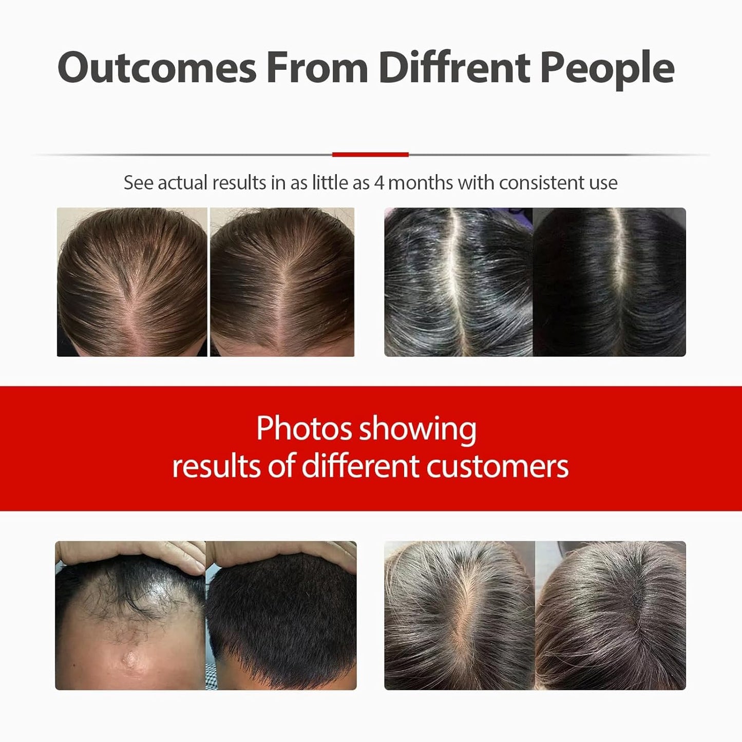 Laser Cap, Red Light Therapy for Hair Growth