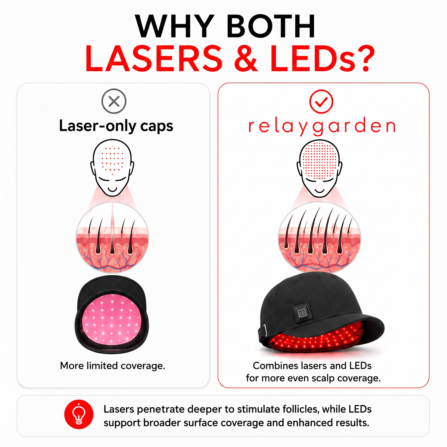 RelayGarden Laser Growth Bundle