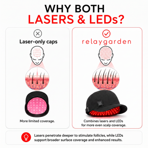 RelayGarden Laser Growth Bundle